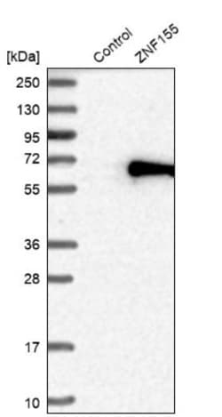 ZNF155 Antibody, Novus Biologicals 25ul | Buy Online | Novus Biologicals | Fisher Scientific